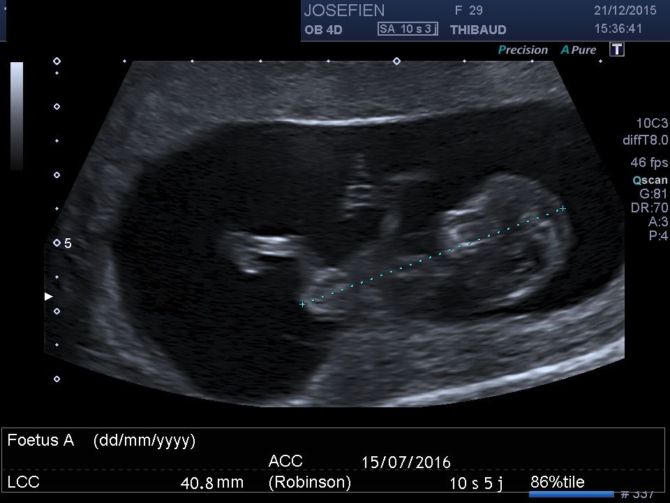 La famille s'agrandit. Ce petit bout de chou est prévu pour juillet 2016.