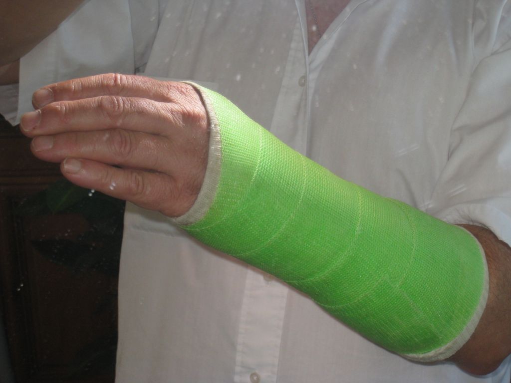 bras vert