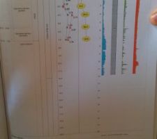 R&eacute;sultat sondage pressiom&eacute;trique