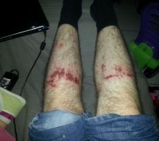 Ouille ouille ouille...