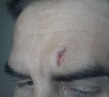 Note à moi même : penser à acheter de l'aspirine pour le mal de crâne de demain .........et une autre massette.