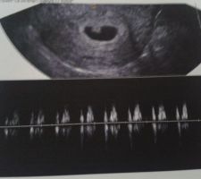 Retour chez nous... et deux jours après une merveilleuse nouvelle <3 Nous rentrons à 3 <3