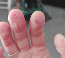 Quand je dis que j'y ai perdu 3 doigts ;)