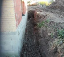 Pr&eacute;paration pour drainage du VS