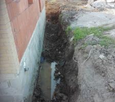 Pr&eacute;paration pour drainage du VS