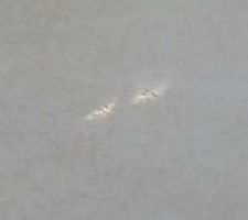 Fissure