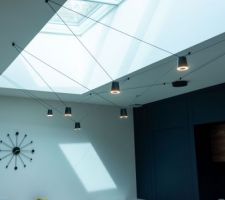 Suspension Sling (KDLN)