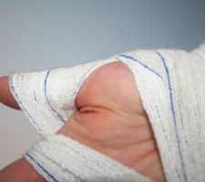 Blessure de guerre