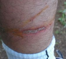 Ah vi... Juste pour vous montrer un de mes mollet...
Conseil du jour : Dans les bottes en caoutchoucs, mettez des grandes et des grosses chaussettes... Sinon ça irrite... un poil !
A éviter en clair...