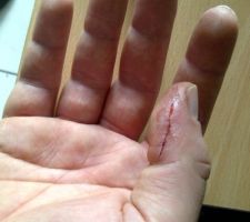 Degats collateraux.....