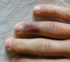 Ne pas essayer de couper une poutrelle b&eacute;ton &agrave; mains nues...